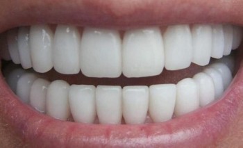 ابتكار جديد سيغير عالم طب الأسنان