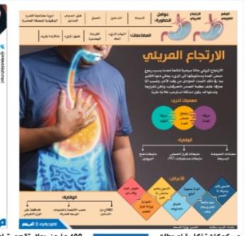 الارتجاع المريئي