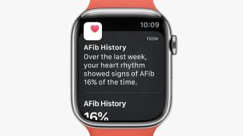 watchOS 9