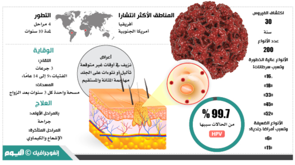 نسبة انتشار الورم الحليمي - اليوم