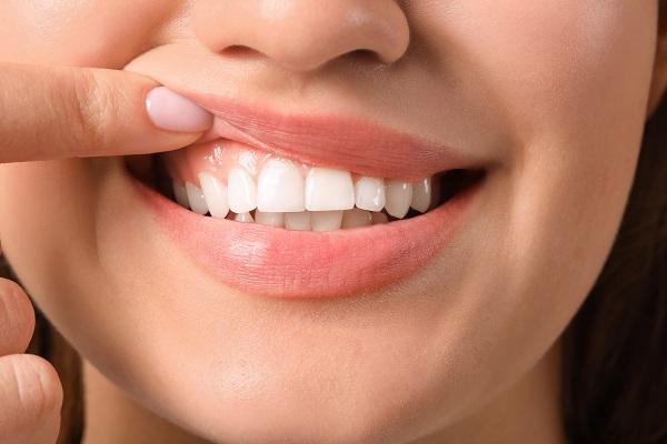 “Warning Signs and Prevention Methods for Gum Disease”